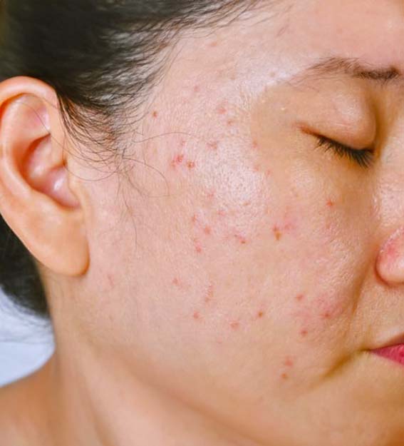 Cosmétologue effectuant un traitement du visage et appliquant un masque facial