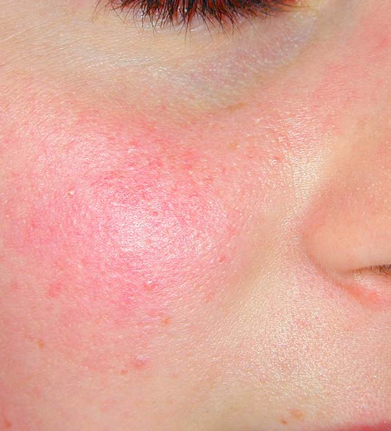 Cosmétologue effectuant un traitement du visage et appliquant un masque facial