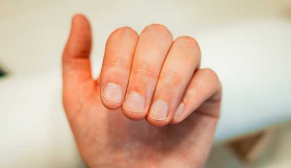 Une main avec des ongles rongés